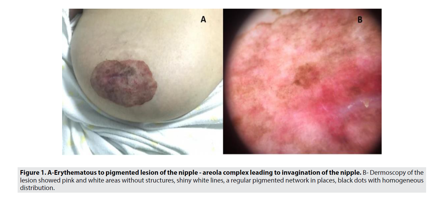 Imaging-Med-pigmented-lesion