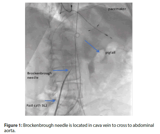 Interventional-Cardiology-abdominal