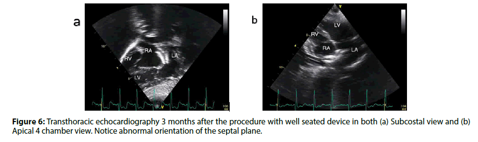 Interventional-Cardiology-abnormal