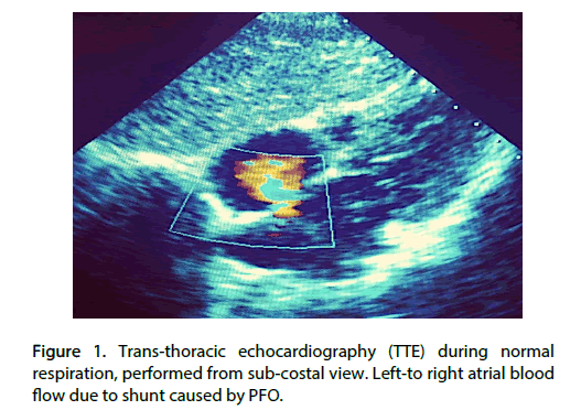 Interventional-Cardiology-alveolar