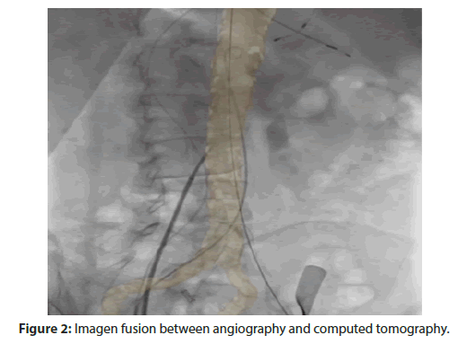 Interventional-Cardiology-angiography