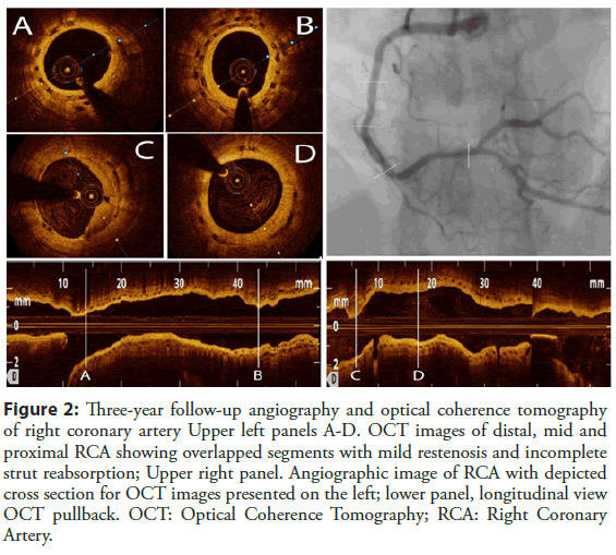 Interventional-Cardiology-angiography