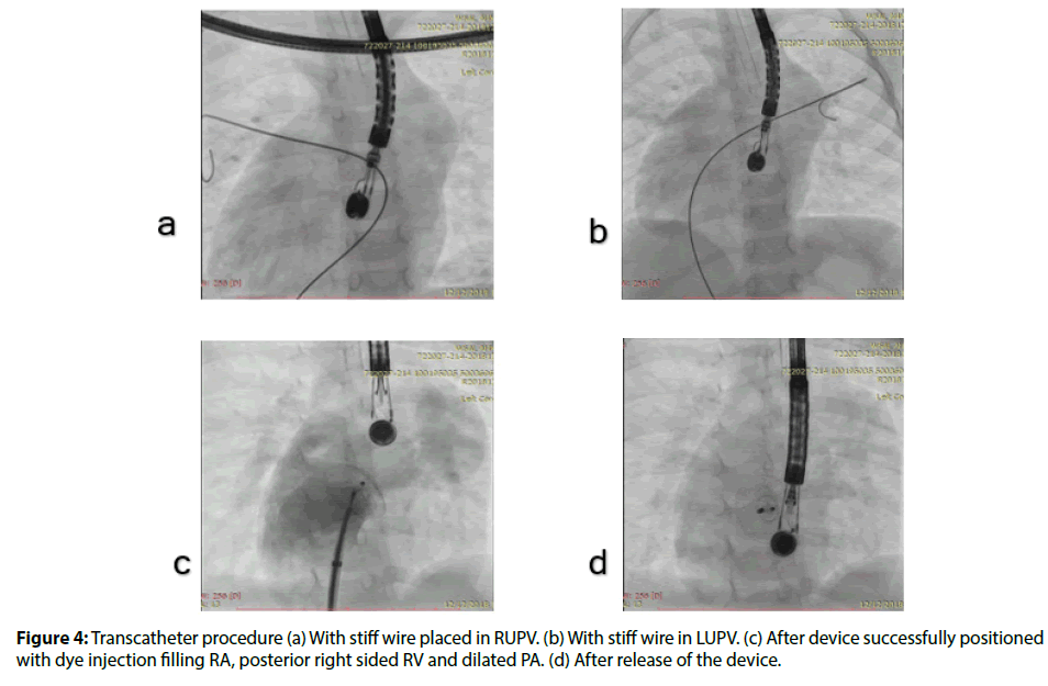 Interventional-Cardiology-assessment