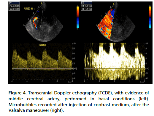 Interventional-Cardiology-cerebral