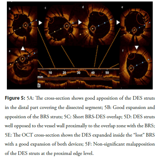 Interventional-Cardiology-cross-section