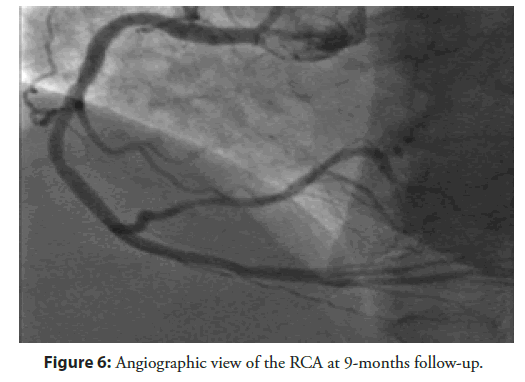 Interventional-Cardiology-cross-view