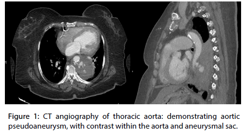 Interventional-Cardiology-demonstrating