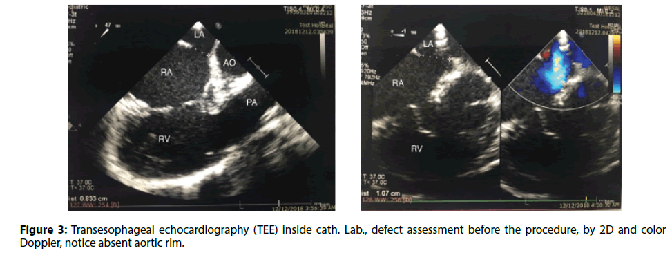 Interventional-Cardiology-echocardiography