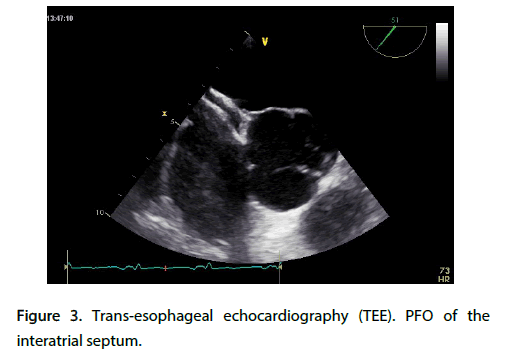Interventional-Cardiology-echocardiography
