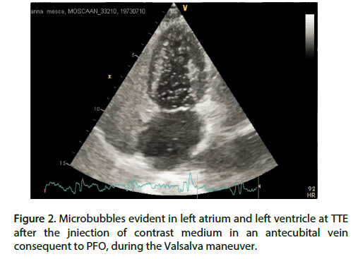 Interventional-Cardiology-evident