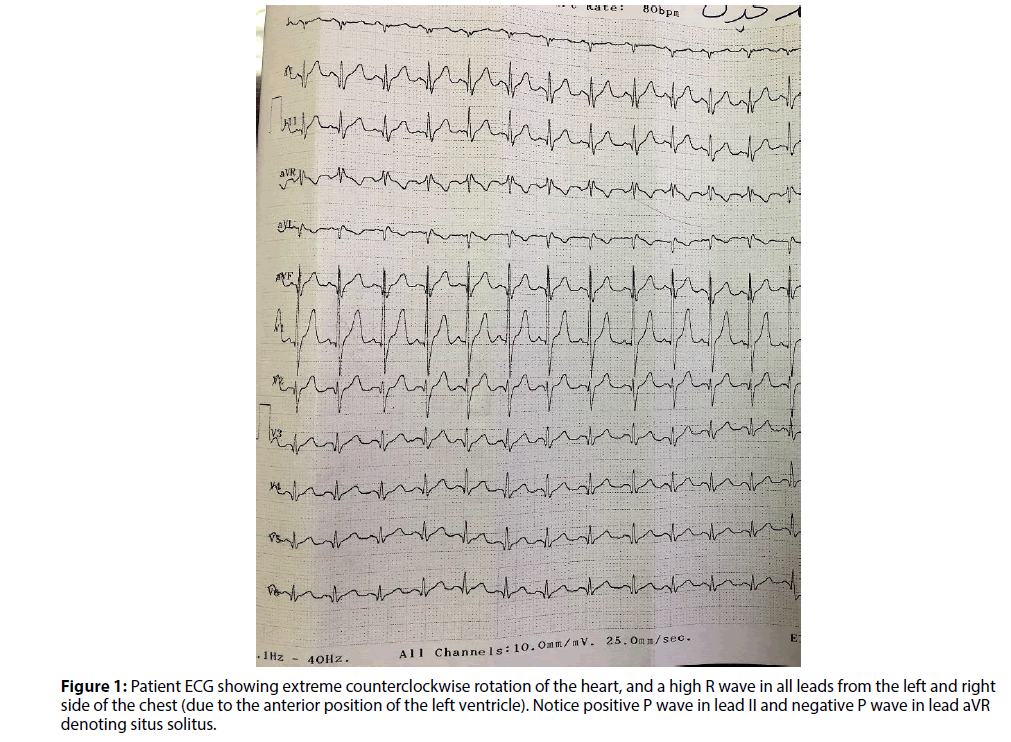 Interventional-Cardiology-extreme