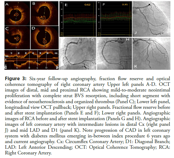 Interventional-Cardiology-fraction