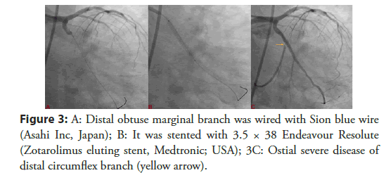 Interventional-Cardiology-marginal