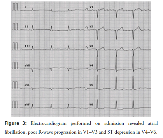 Interventional-Cardiology-performed