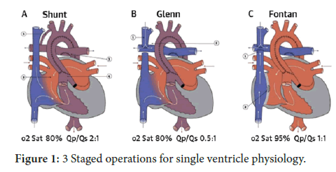 Interventional-Cardiology-physiology