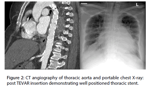 Interventional-Cardiology-portable