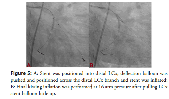 Interventional-Cardiology-positioned