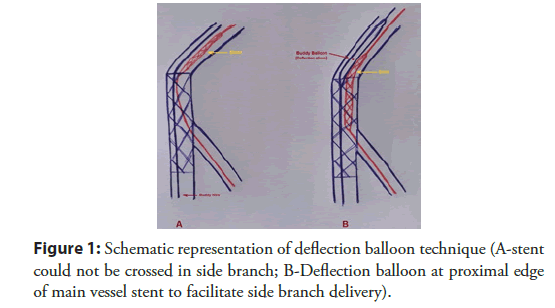 Interventional-Cardiology-representation