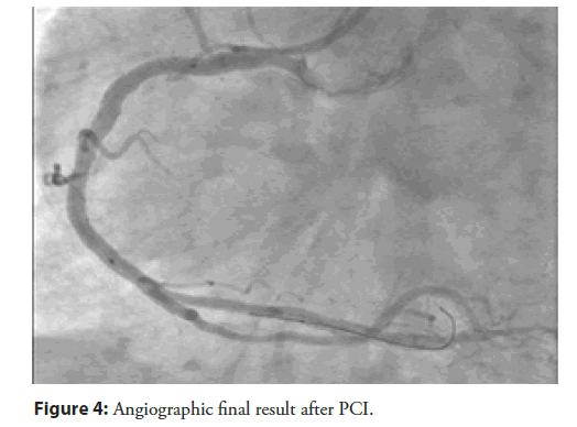 Interventional-Cardiology-result