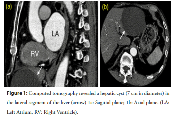 Interventional-Cardiology-revealed