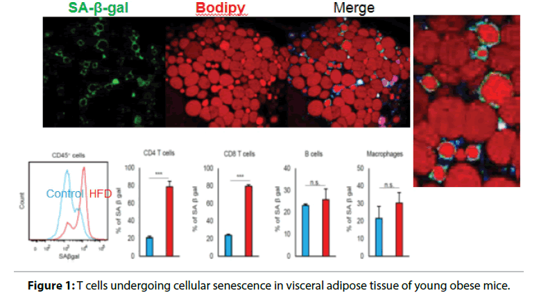 Interventional-Cardiology-senescence
