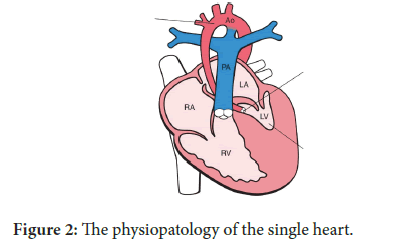 Interventional-Cardiology-single-heart