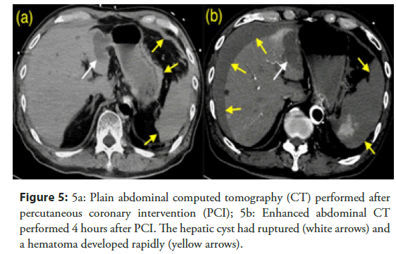 Interventional-Cardiology-tomography