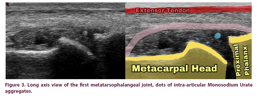 article-clinical-rheumatology-intra-articular