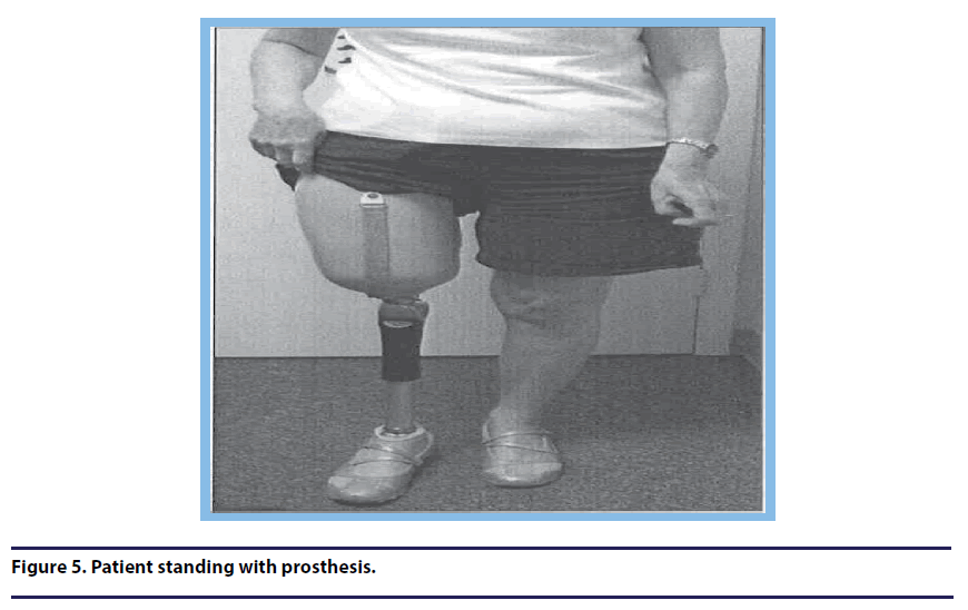 chronic-diseases-prosthesis