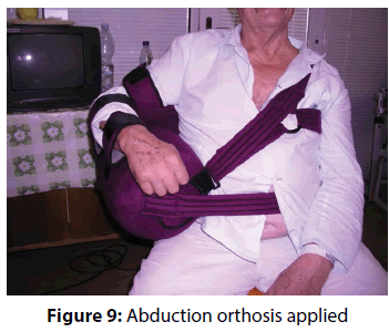 clinical-investigation-Abduction-orthosis