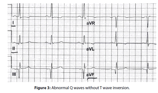 clinical-investigation-Abnormal-waves