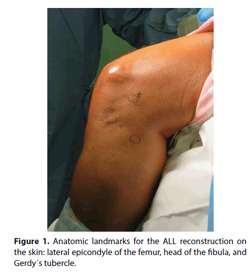 clinical-investigation-Anatomic-landmarks