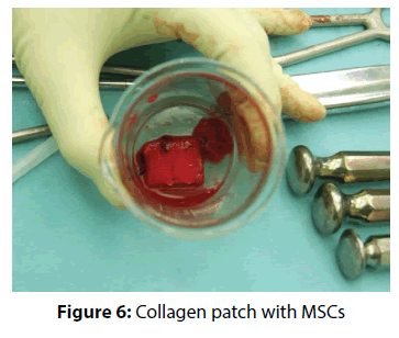 clinical-investigation-Collagen-patch