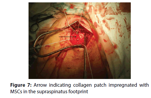 clinical-investigation-Collagen-patch