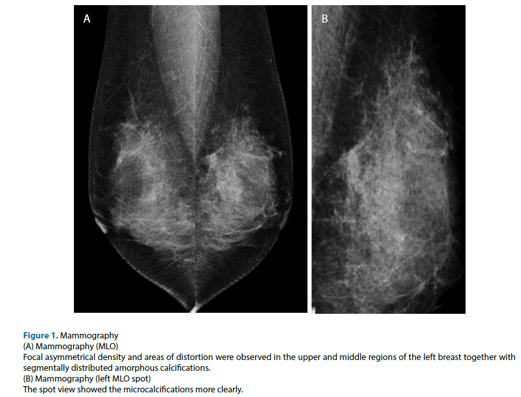 clinical-investigation-Mammography