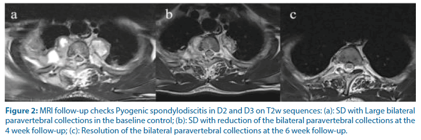 clinical-investigation-bilateral-paravertebral