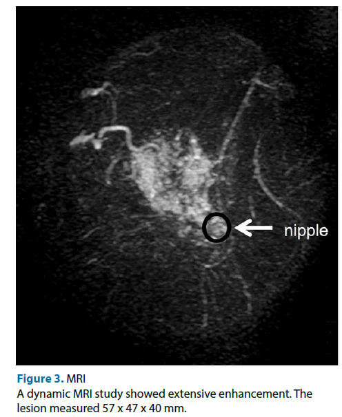 clinical-investigation-extensive-enhancement