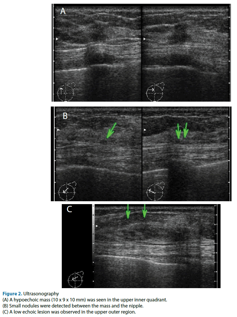 clinical-investigation-hypoechoic-mass