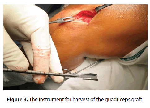 clinical-investigation-instrument-harvest