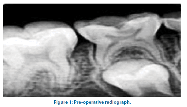 clinical-investigation-radiograph