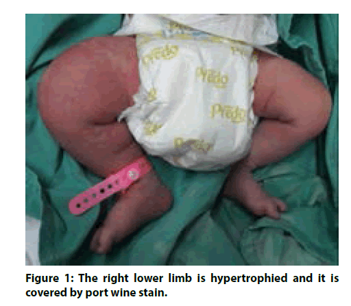 clinical-investigation-right-lower