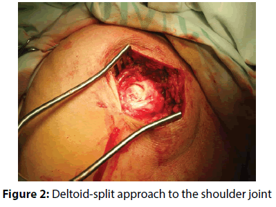 clinical-investigation-shoulder-joint