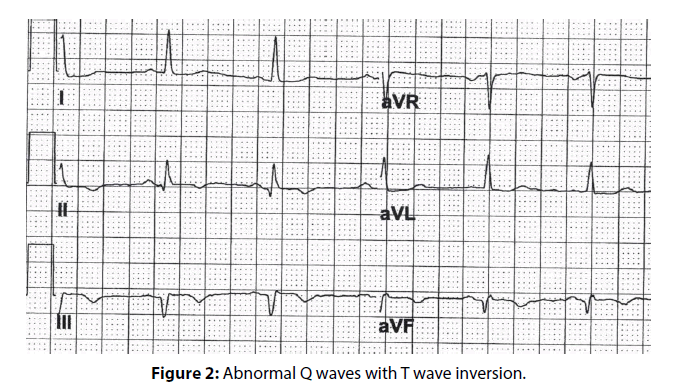 clinical-investigation-wave-inversion