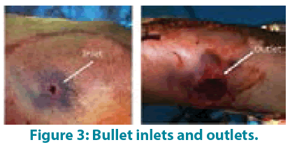 clinical-practice-Bullet-inlets