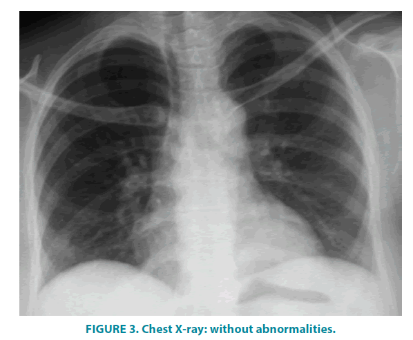 clinical-practice-Chest-X-ray