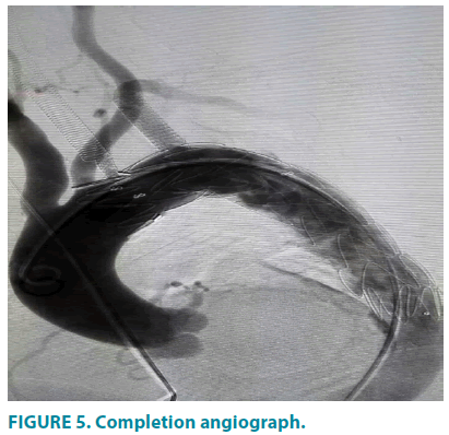 clinical-practice-Completion-angiograph