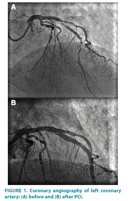 clinical-practice-Coronary-angiography