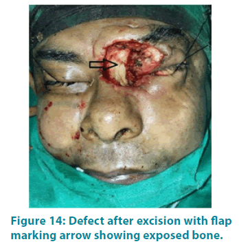 clinical-practice-Defect-after