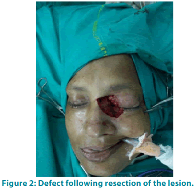 clinical-practice-Defect-following