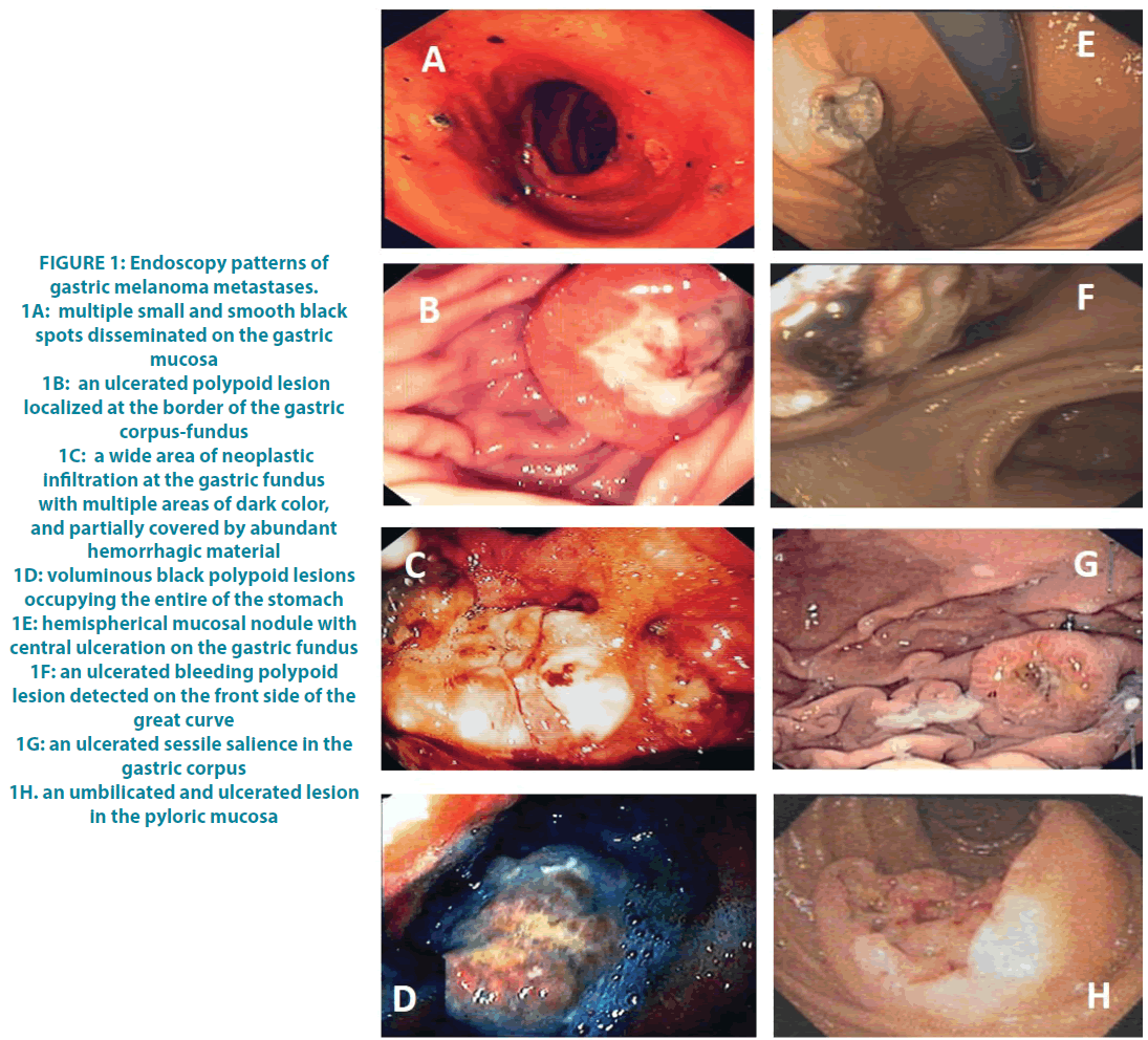 clinical-practice-Endoscopy-patterns